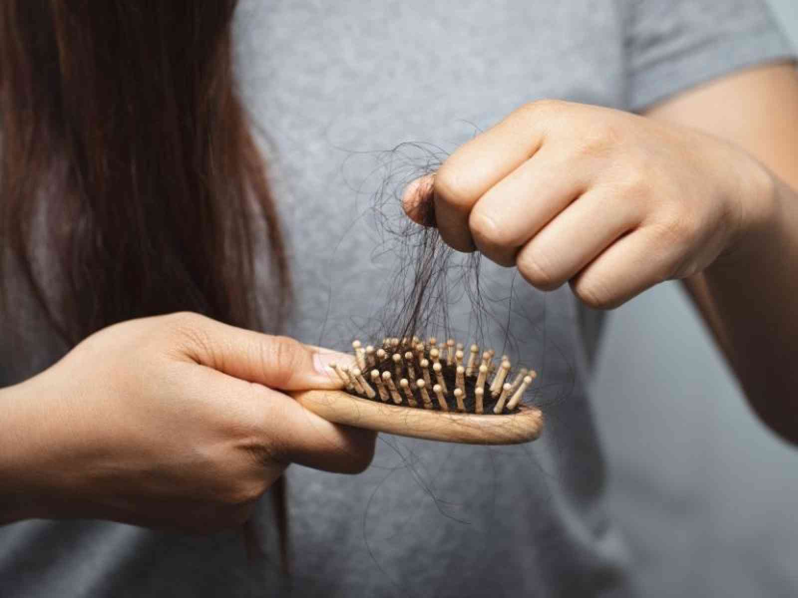 Hair Loss After Bariatric Surgery: Causes & Solutions