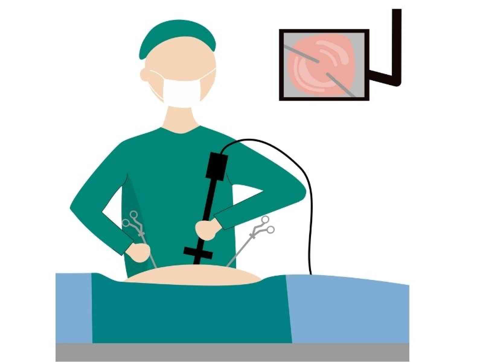Frequently Asked Questions About Laparoscopic Surgery
