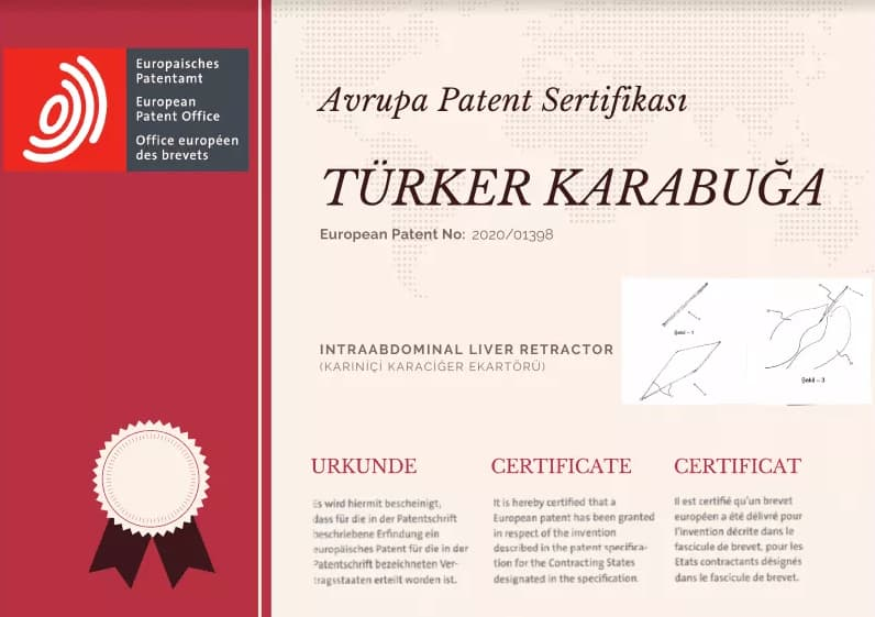 Double Gastric Balloon